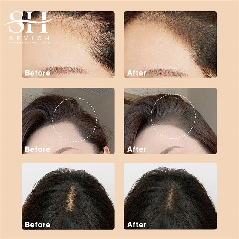 SEVICH 12g Hairline Powder Wit - Rooting Hormone Powder reseña y precio