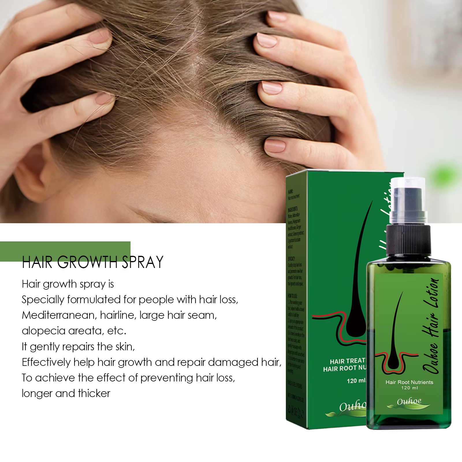 Hair Growth Spray Anti Hair Lo - Root Stimulator Liquid reseña y precio